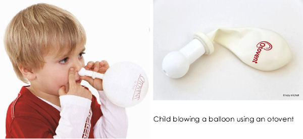 left: Blowing balloons ‘treats Glue Ear’ (Source: BBC News, 2015)  right: otovent